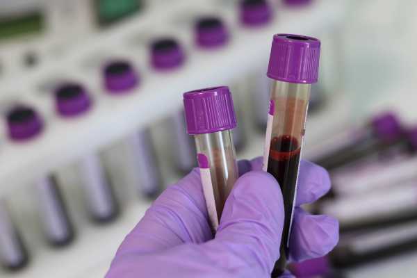 Νέα εξέταση αίματος ανιχνεύει τρεις τύπους καρκίνου μέσα σε λίγα λεπτά